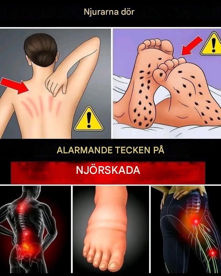 15 dödliga tecken på njursjukdom att upptäcka tidigt