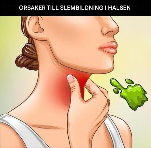De verkliga orsakerna till konstant slem och mukus i halsen och hur man blir av med det
