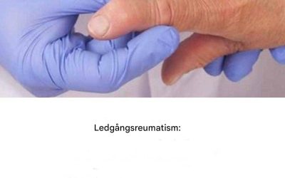 Att leva med reumatoid artrit: dagliga utmaningar