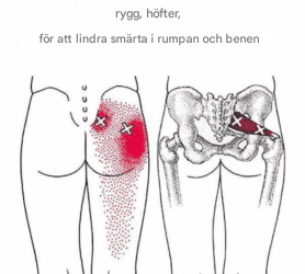 Hur man får en djup piriformisstretch för att eliminera smärta i rygg, höft, rumpa och ben