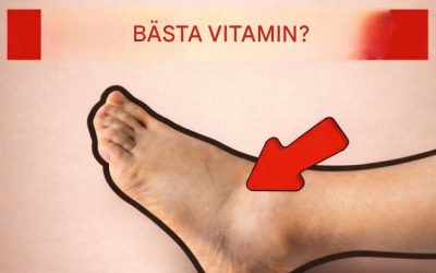 Topp 5 näringsämnen för att minska svullnad i fötter och ben