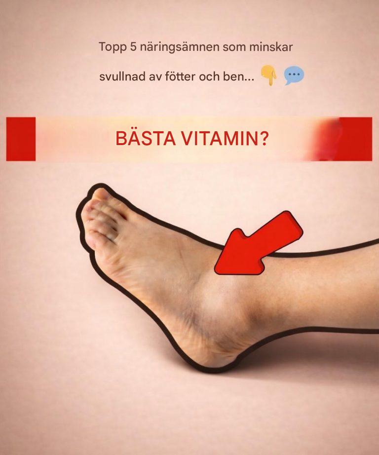 Topp 5 näringsämnen för att minska svullnad i fötter och ben