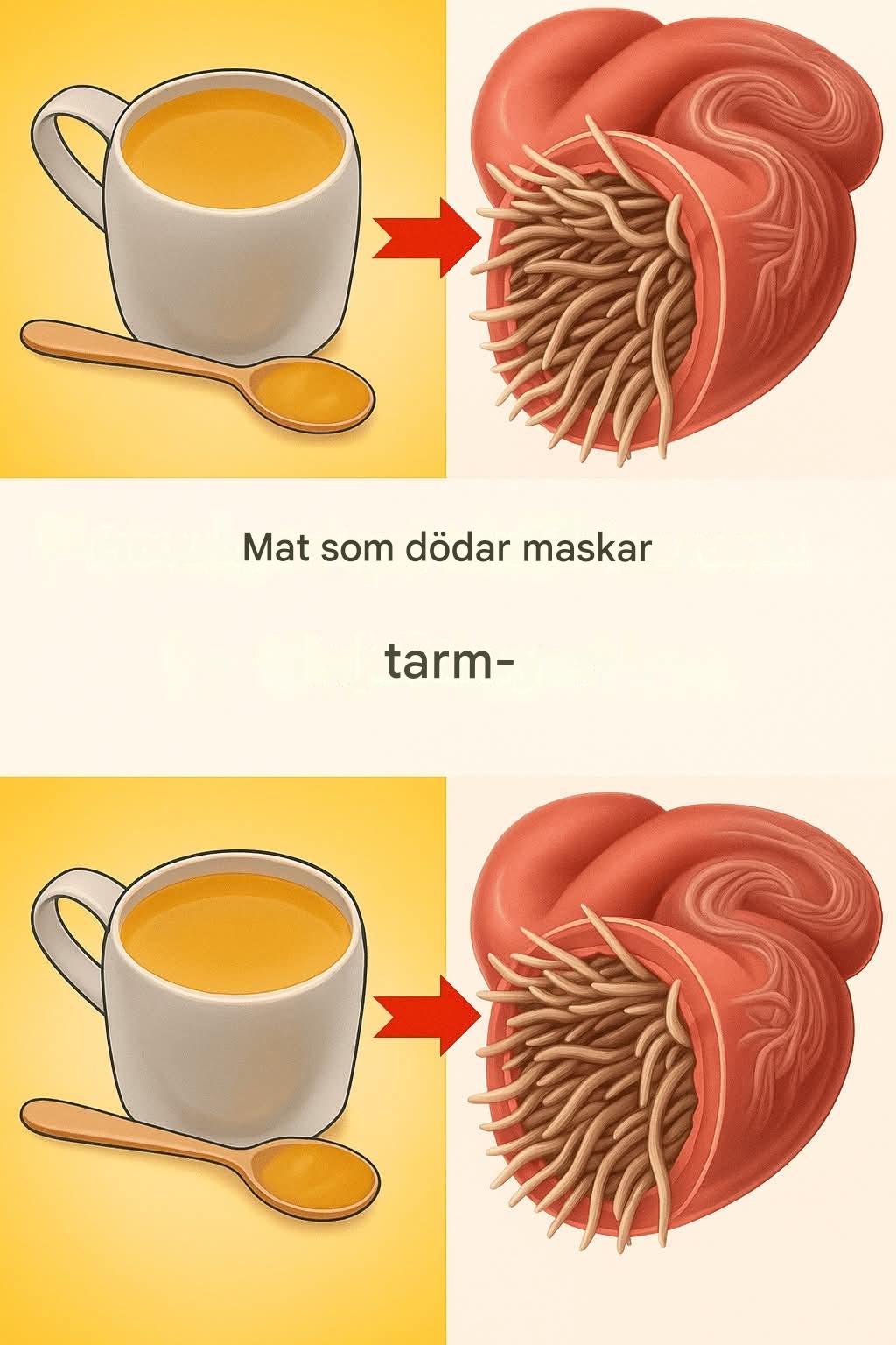 7 livsmedel som dödar tarmmaskar
