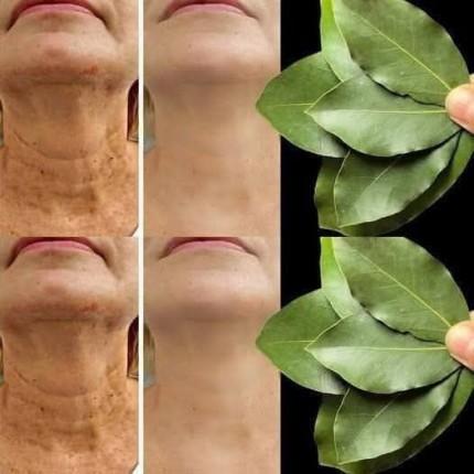 Lagerblad: 100 000 gånger mer effektivt än Botox för att ta bort rynkor även efter 70 års ålder