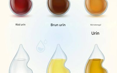 ad säger färgen på din urin om din hälsa?
