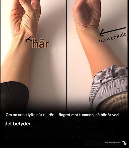 Om en sena lyfts när du rör lillfingret med tummen, kan det betyda följande.