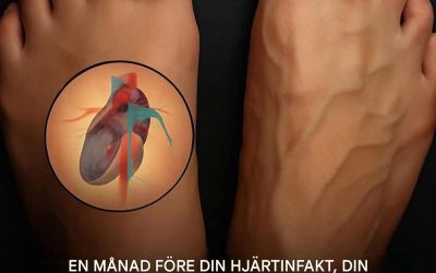 Vilka är varningssignalerna på en hjärtinfarkt?