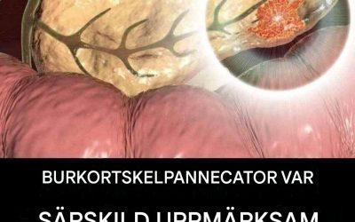 Bukspottkörtelcancer: två varningstecken som borde oroa dig (1/2)