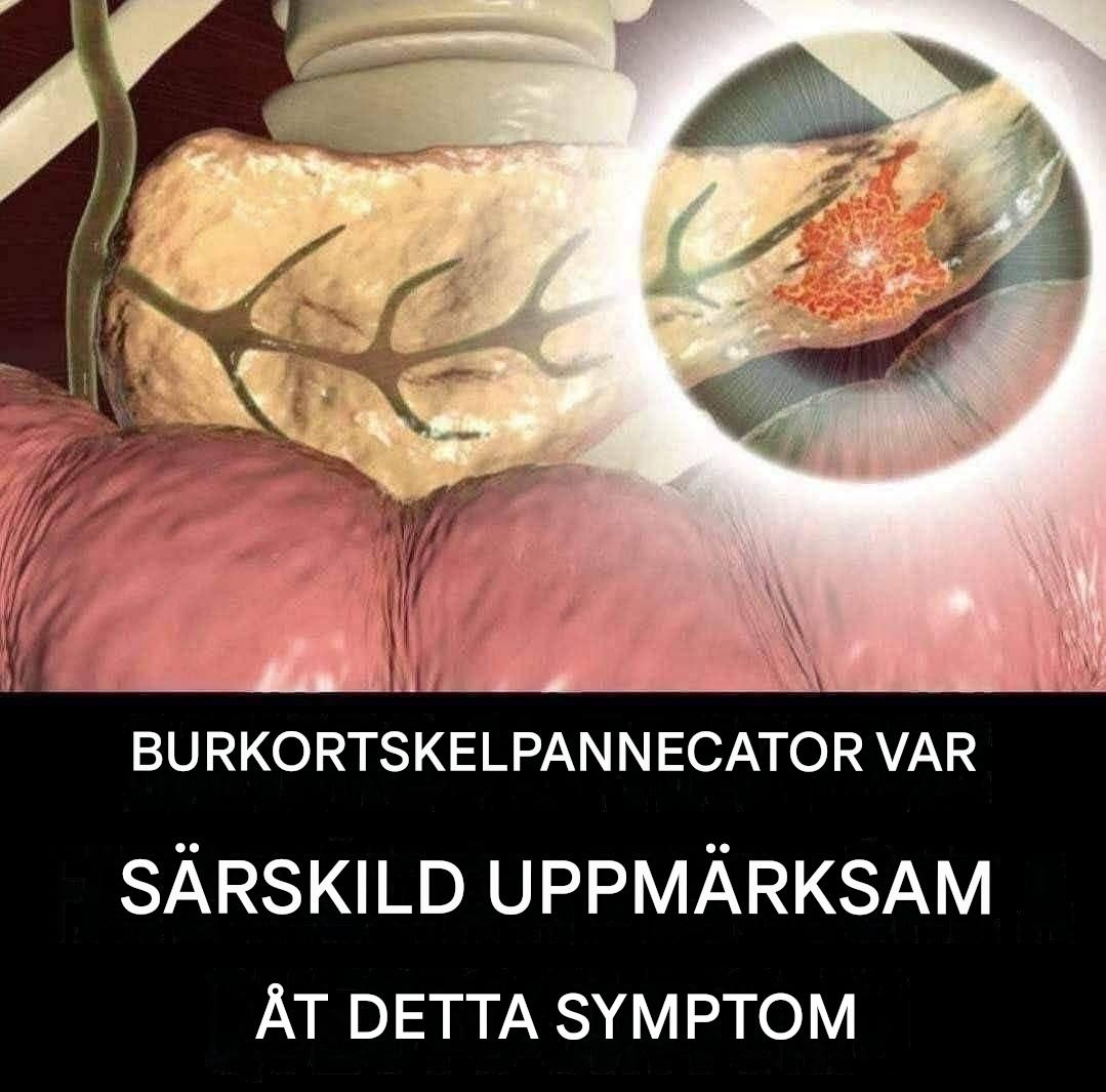 Bukspottkörtelcancer: två varningstecken som borde oroa dig (1/2)