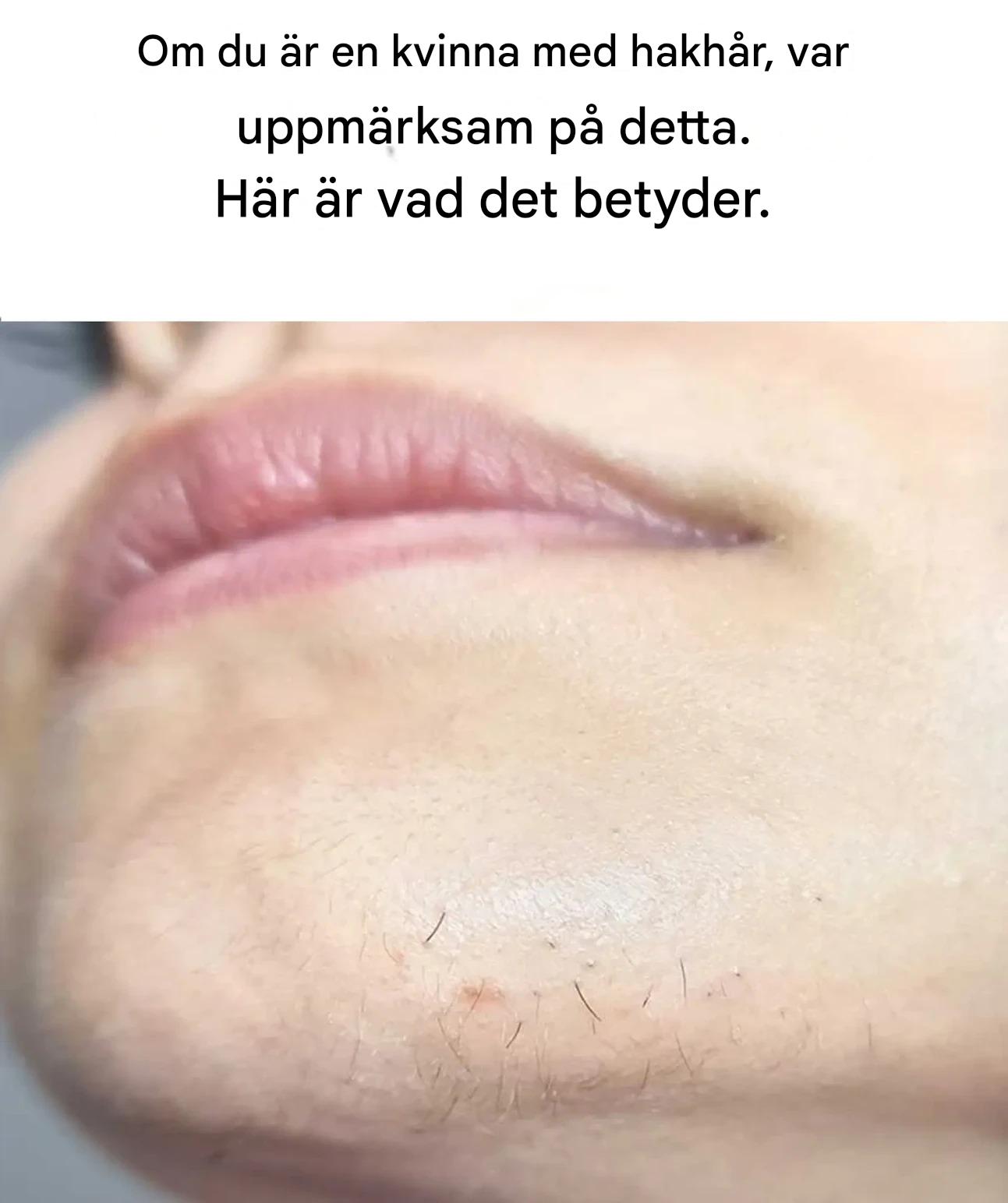 Om du är en kvinna med hår på hakan, var uppmärksam. Här är vad det betyder.