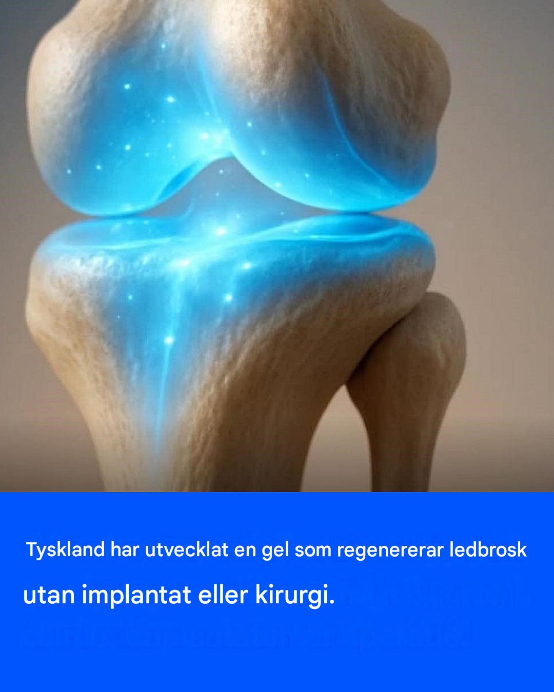Tyskland har utvecklat en gel som regenererar ledbrosk utan implantat eller kirurgi.