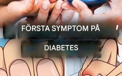Här är de mest överraskande symtomen på diabetes (1/3)
