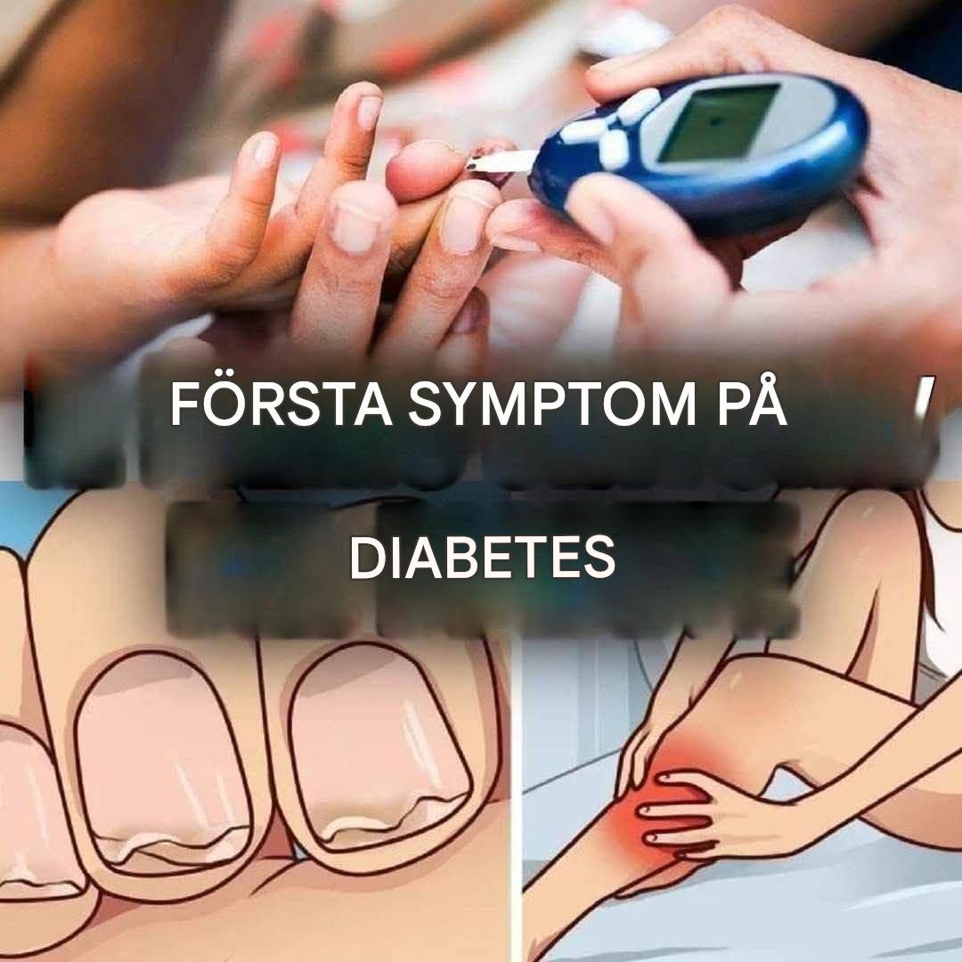 Här är de mest överraskande symtomen på diabetes (1/3)