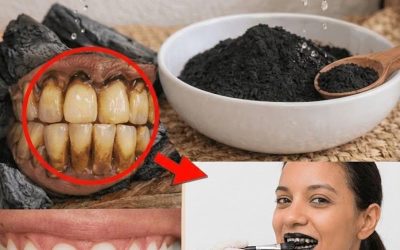 12 naturliga sätt att stödja friskare tänder och ett större leende hemma
