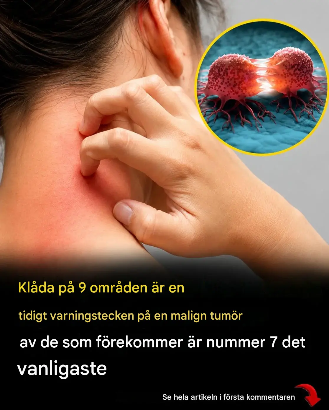Mer än 15 tidiga varningstecken på cancer som du aldrig bör ignorera