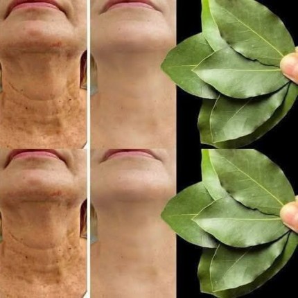 Lagerblad: 100 000 gånger mer effektivt än Botox för att ta bort rynkor även efter 70 års ålder