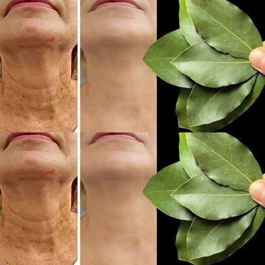 Vad används Botox till? | Naturlig anti-rough-behandling bara 70 ml!