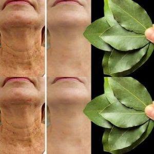 Är lagerblad 100 000 gånger kraftfullare än Botox? | Ett naturligt sätt att ta bort rynkor även vid 70!
