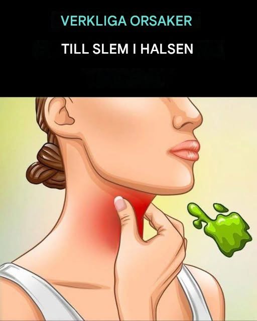 De verkliga orsakerna till konstant slem och mukus i halsen och hur man blir av med det