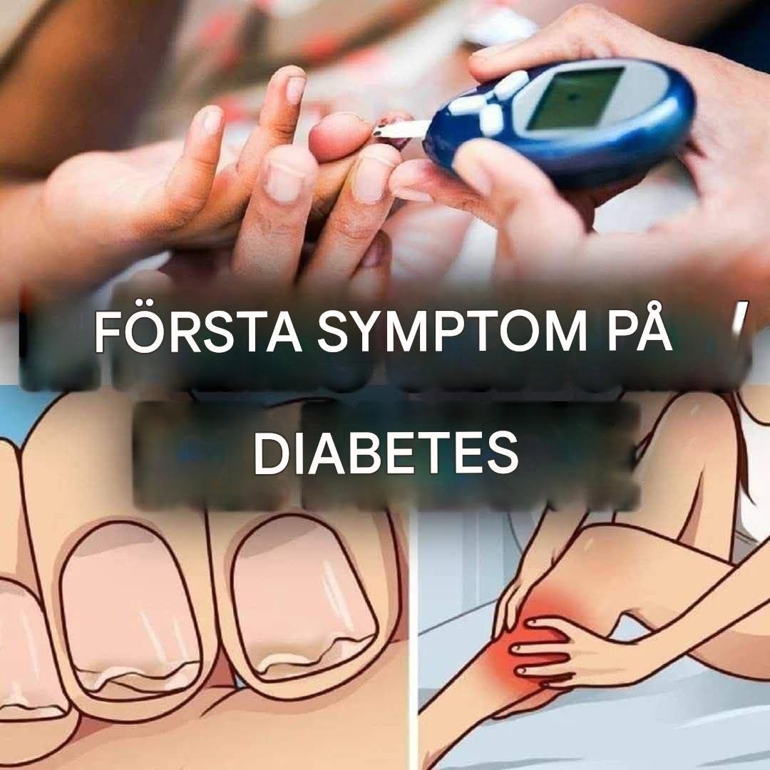 Dessa är de mest överraskande symtomen på diabetes (1/3)