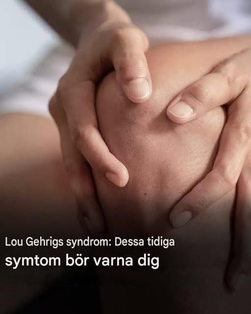 Lou Gehrigs syndrom: Här är de första symtomen på denna sjukdom