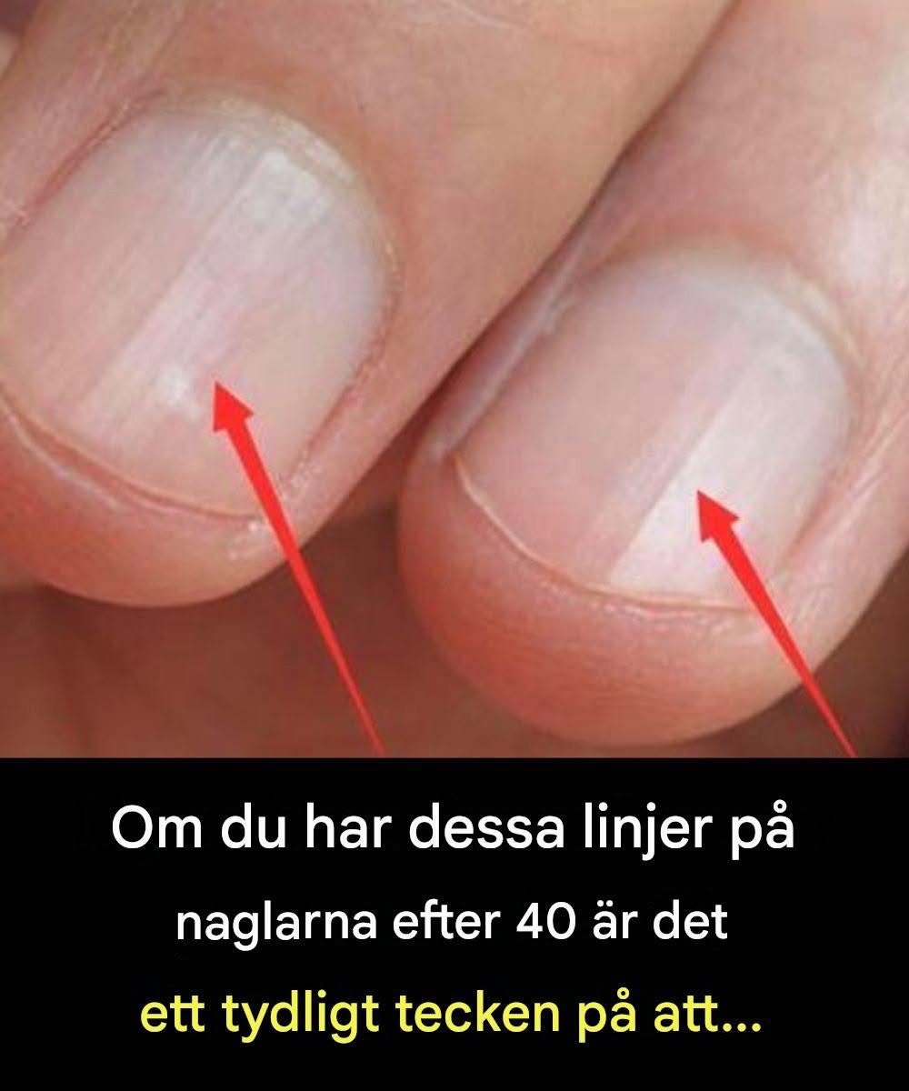 De bästa matvarorna för starkare naglar efter 40