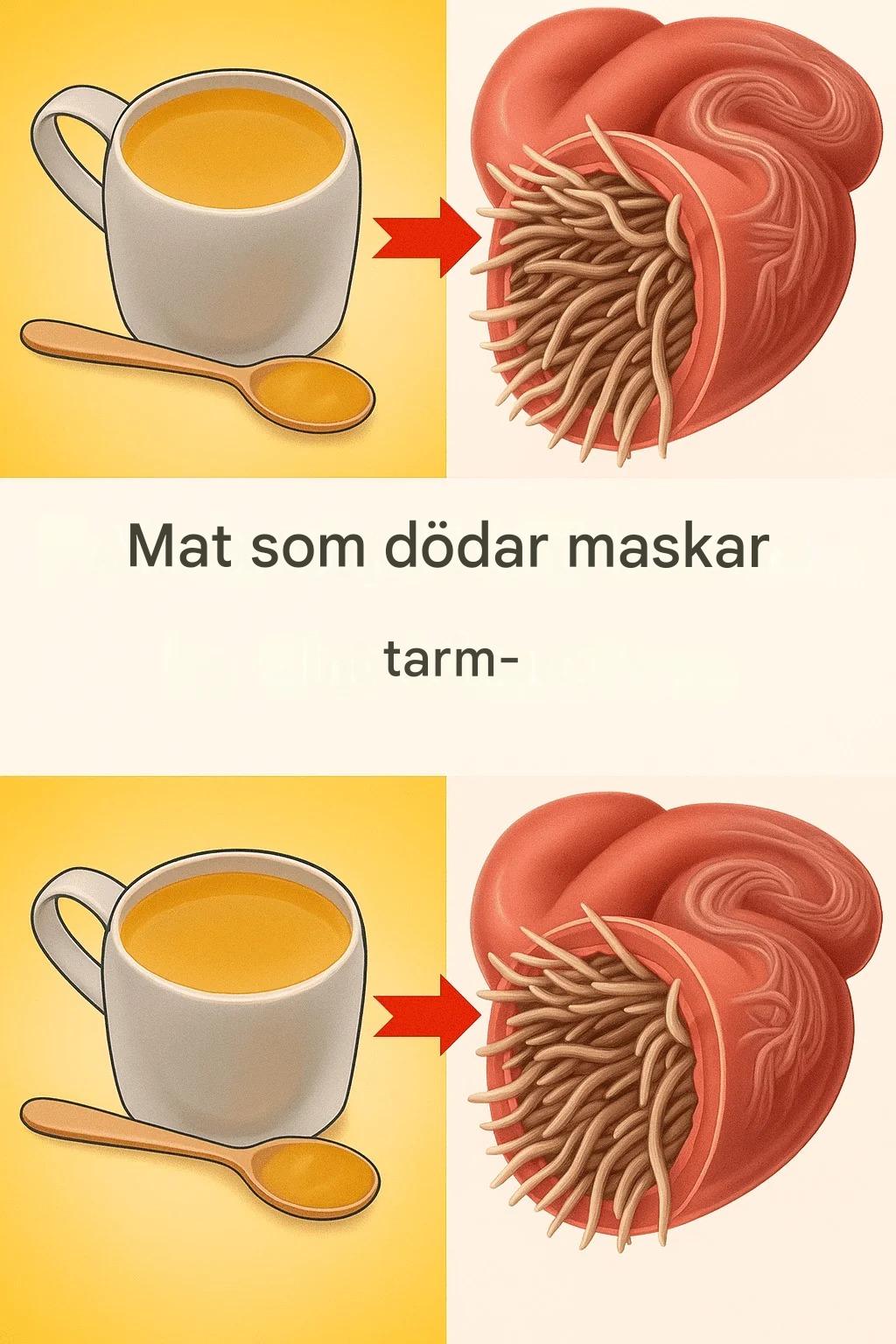 7 livsmedel som dödar inälvsmask…?