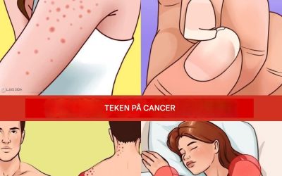 12 varningstecken på att cancerceller utvecklas i din kropp