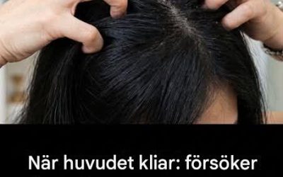 Kliar din hårbotten? Vi kommer att förklara orsakerna till problemet åt dig.
