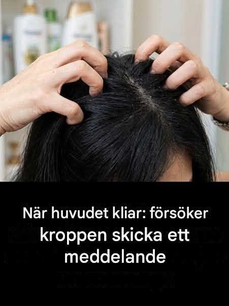 Kliar din hårbotten? Vi kommer att förklara orsakerna till problemet åt dig.