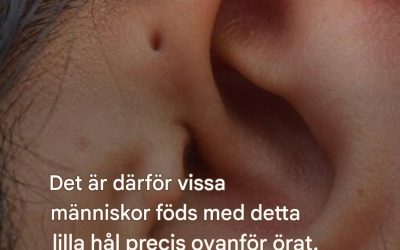 Är det därför vissa människor föds med det där lilla hålet precis ovanför örat?