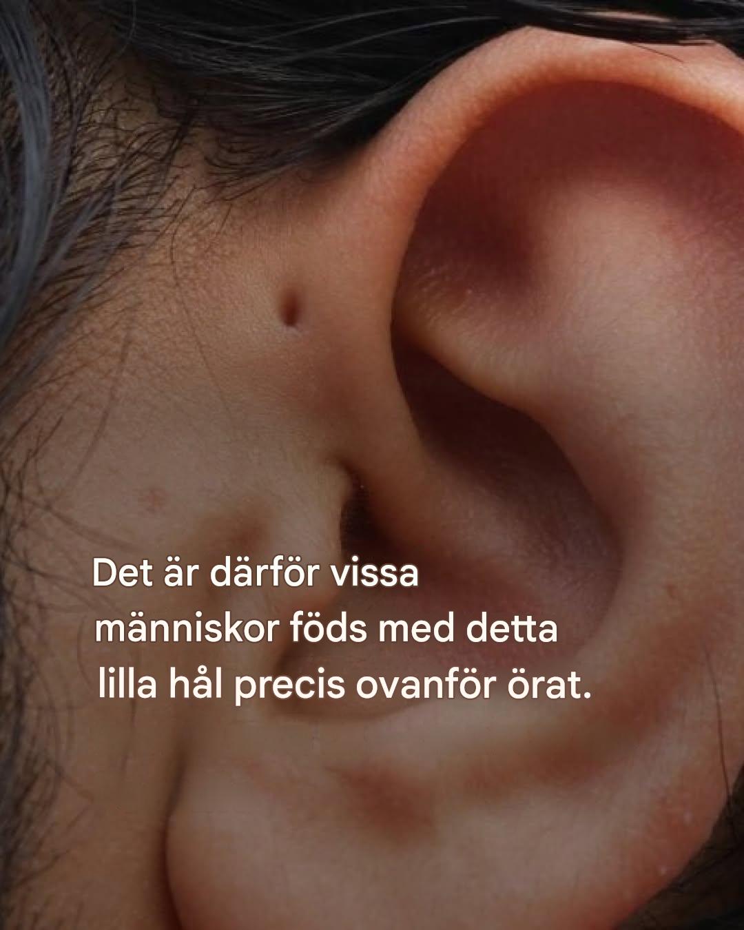 Är det därför vissa människor föds med det där lilla hålet precis ovanför örat?