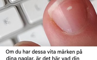 Vitprickiga naglar: myt eller varningstecken?