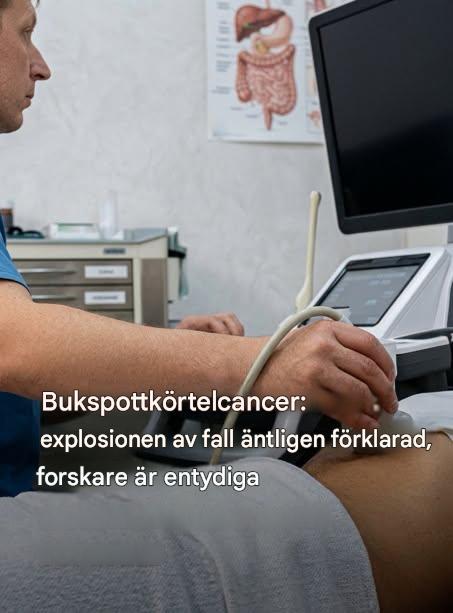 Bukspottkörtelcancer: bakom ökningen av fall utforskar forskare oväntade vägar