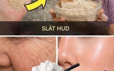 Jäst och yoghurt eliminerar alla rynkor på 3 minuter. Även vid 70! Lämna en kommentar för att fortsätta få mina recept. Hela receptet finns i den första kommentaren.