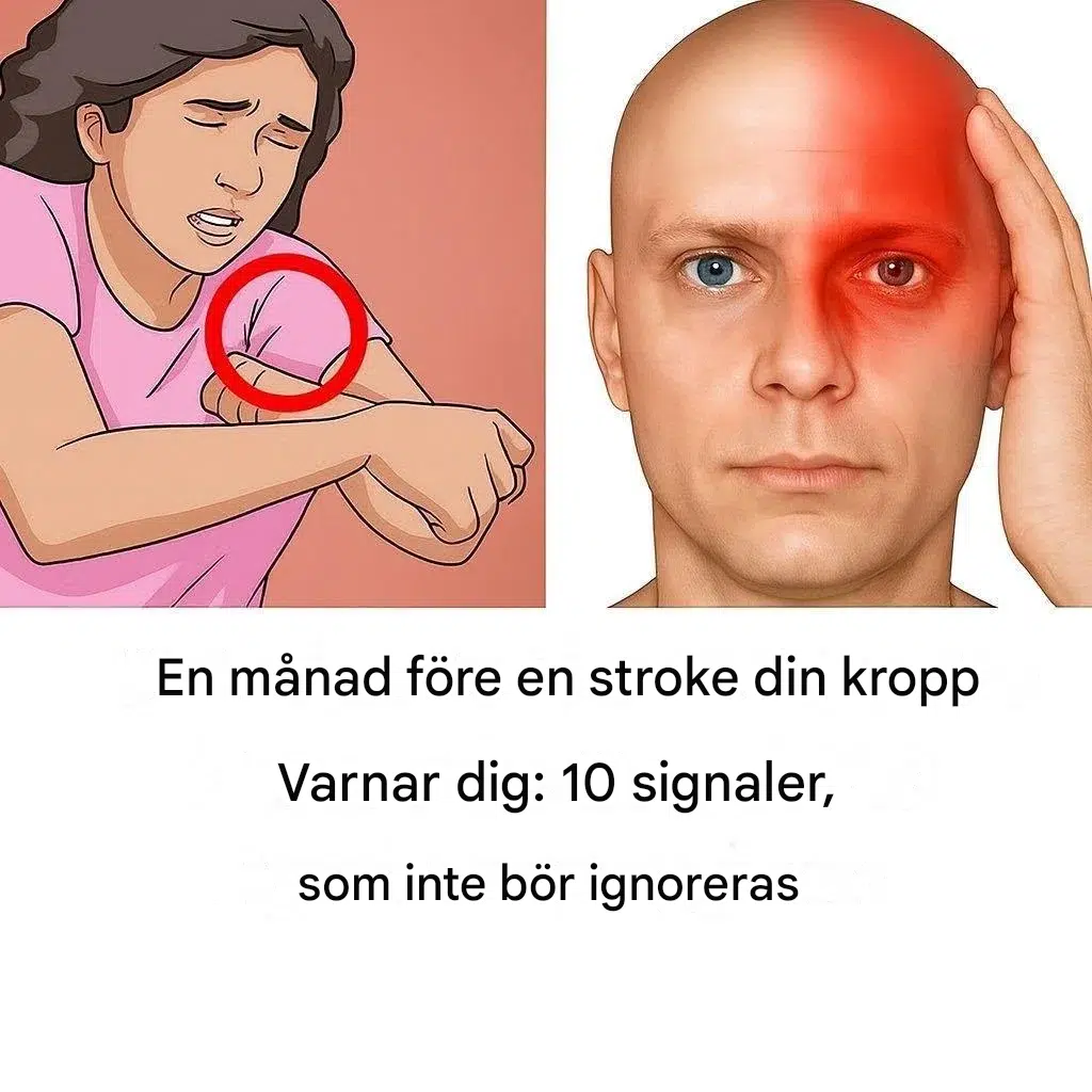 En månad före en stroke varnar din kropp dig: 10 signaler du inte bör ignorera