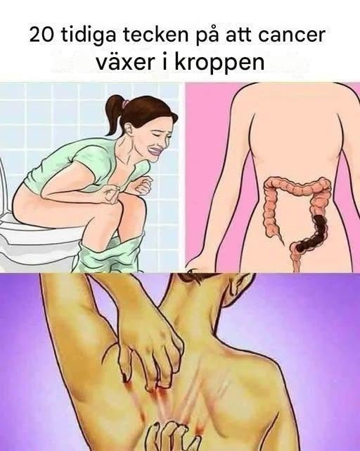20 subtila cancersymptom som ofta missas