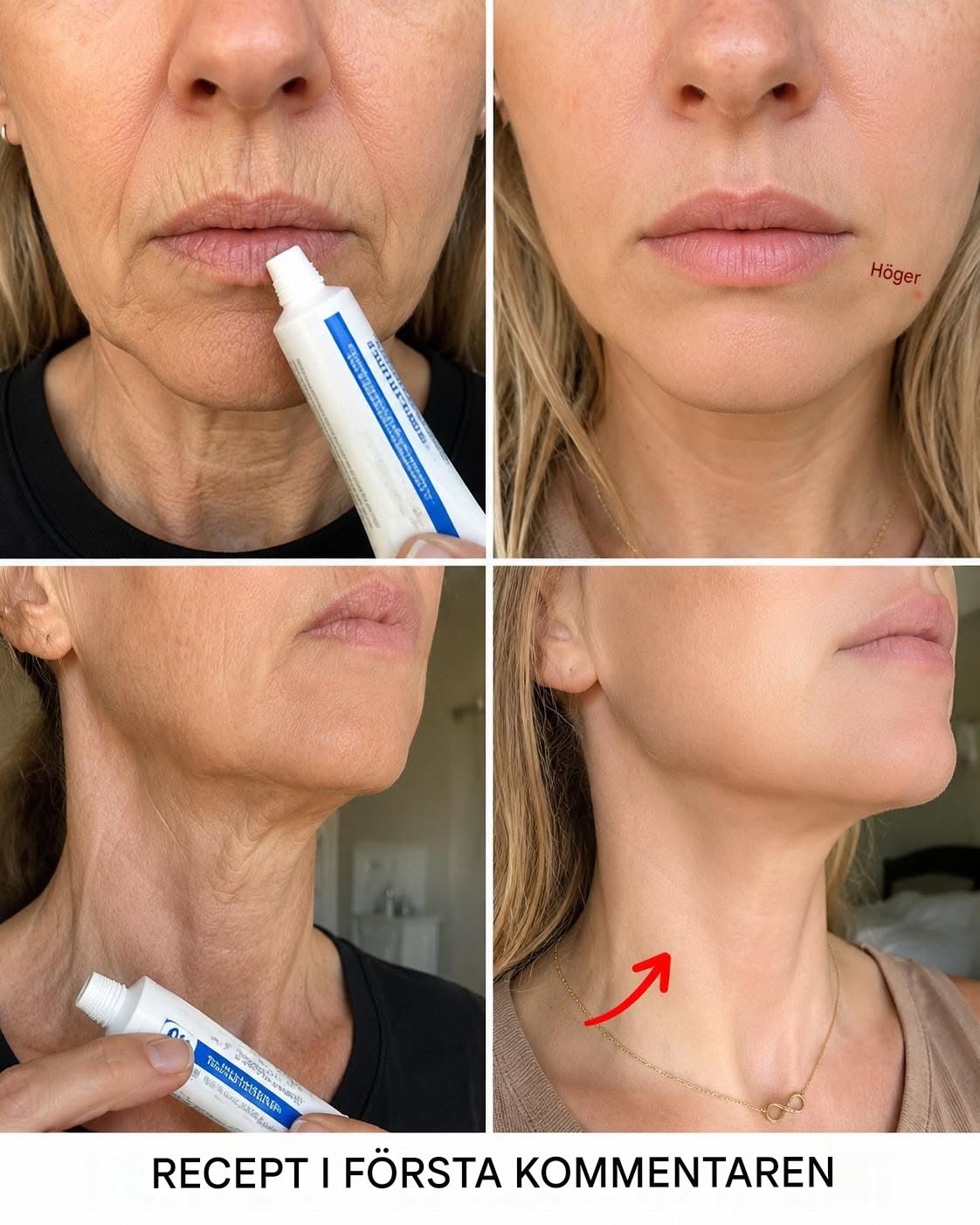 “Det ser ut som att jag har genomgått plastikkirurgi”: Ett huskur som används för att förbättra rynkor och mörka fläckar på händer och armar. För att fortsätta få mina recept, säg bara… Tack!