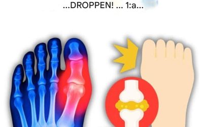 “Min stortå brann… tills jag upptäckte dessa 5 drycker som naturligt eliminerar urinsyra!”
