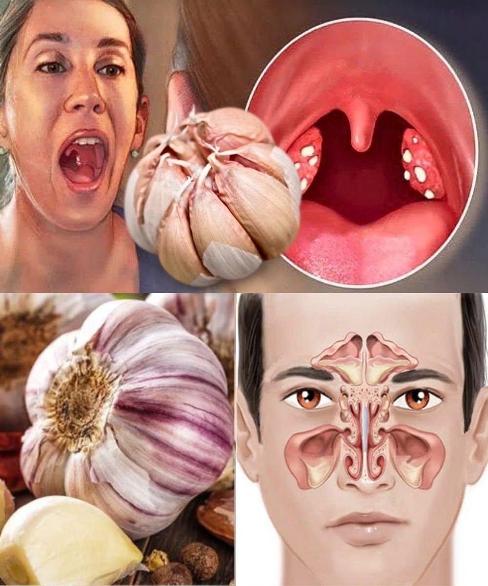 Vitlök mot infektioner: 12 bevisade fördelar och hur man använder den naturligt