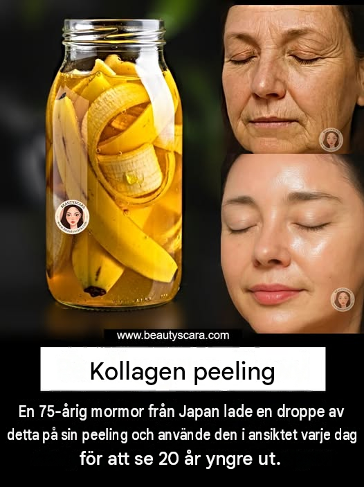 Gnugga bananskal i ansiktet för ren hud – ta bort finnar och mörka fläckar