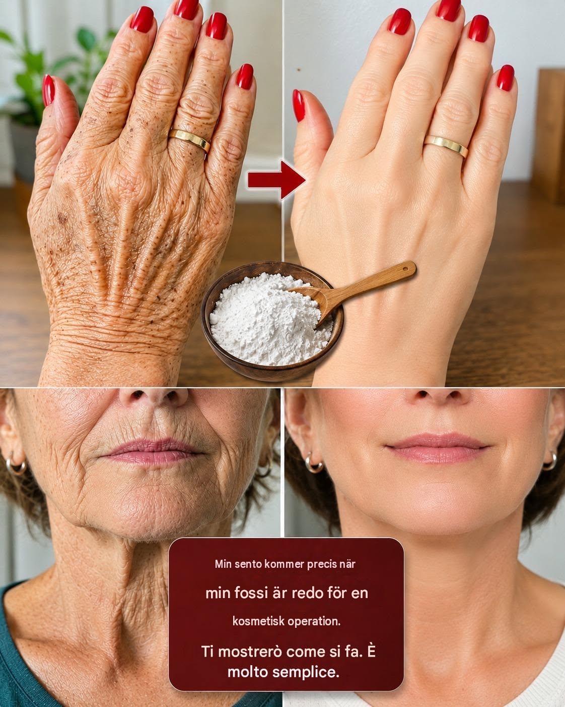 “Jag ser ut som om jag genomgått plastikkirurgi”: Ett hemmagjort sätt att förbättra utseendet på rynkor och deformationer på mina händer och axlar. För att fortsätta få mina recept, säg bara… Tack!