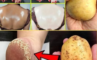 13 geniala skönhetsanvändningar av potatis för hår, hud, ögon och mer 👇 Detaljer i första kommentaren