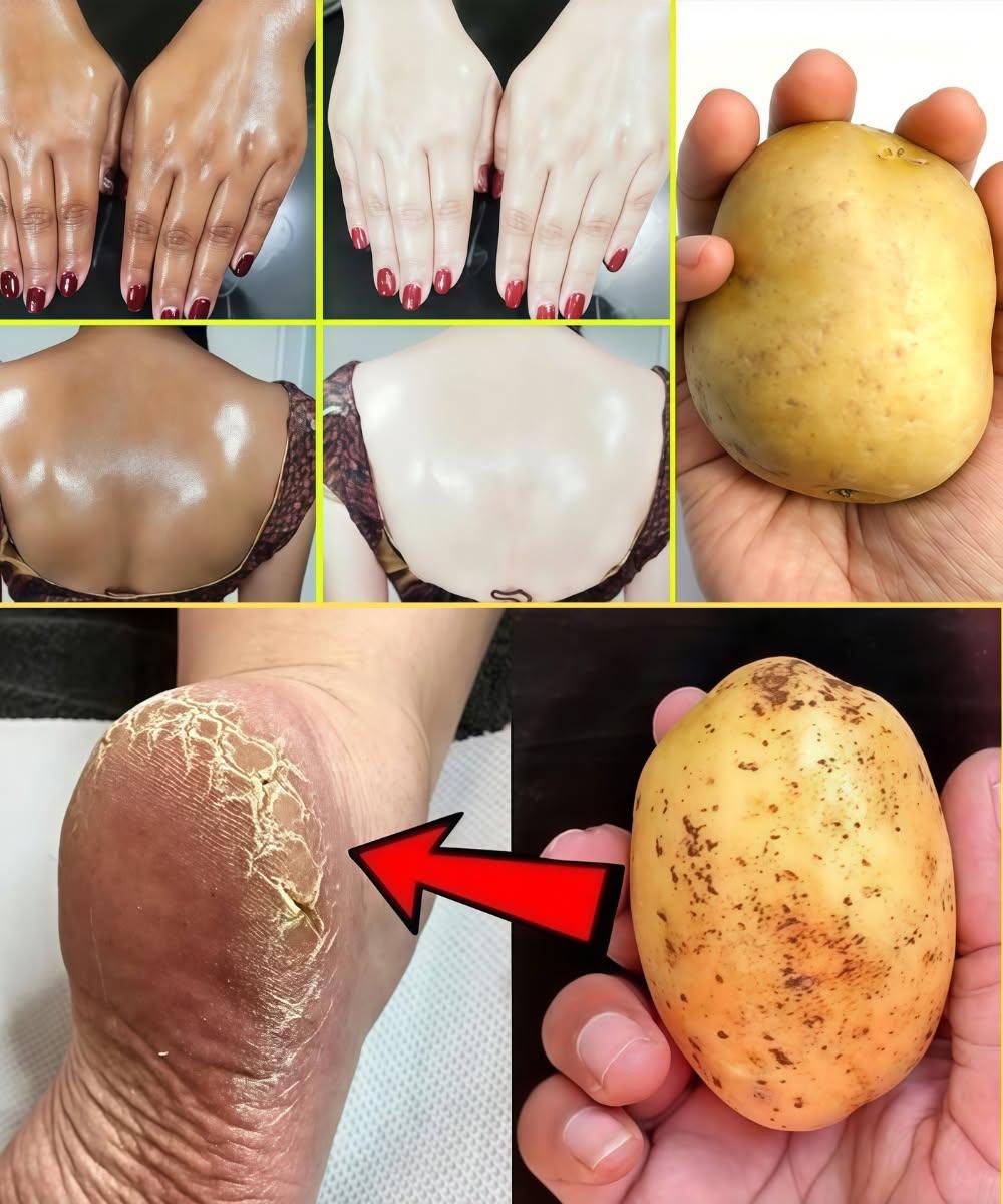 13 geniala skönhetsanvändningar av potatis för hår, hud, ögon och mer 👇 Detaljer i första kommentaren