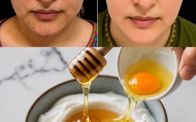 Hur man använder ägg och citron för en gör-det-själv-ansiktsbehandling som gör underverk