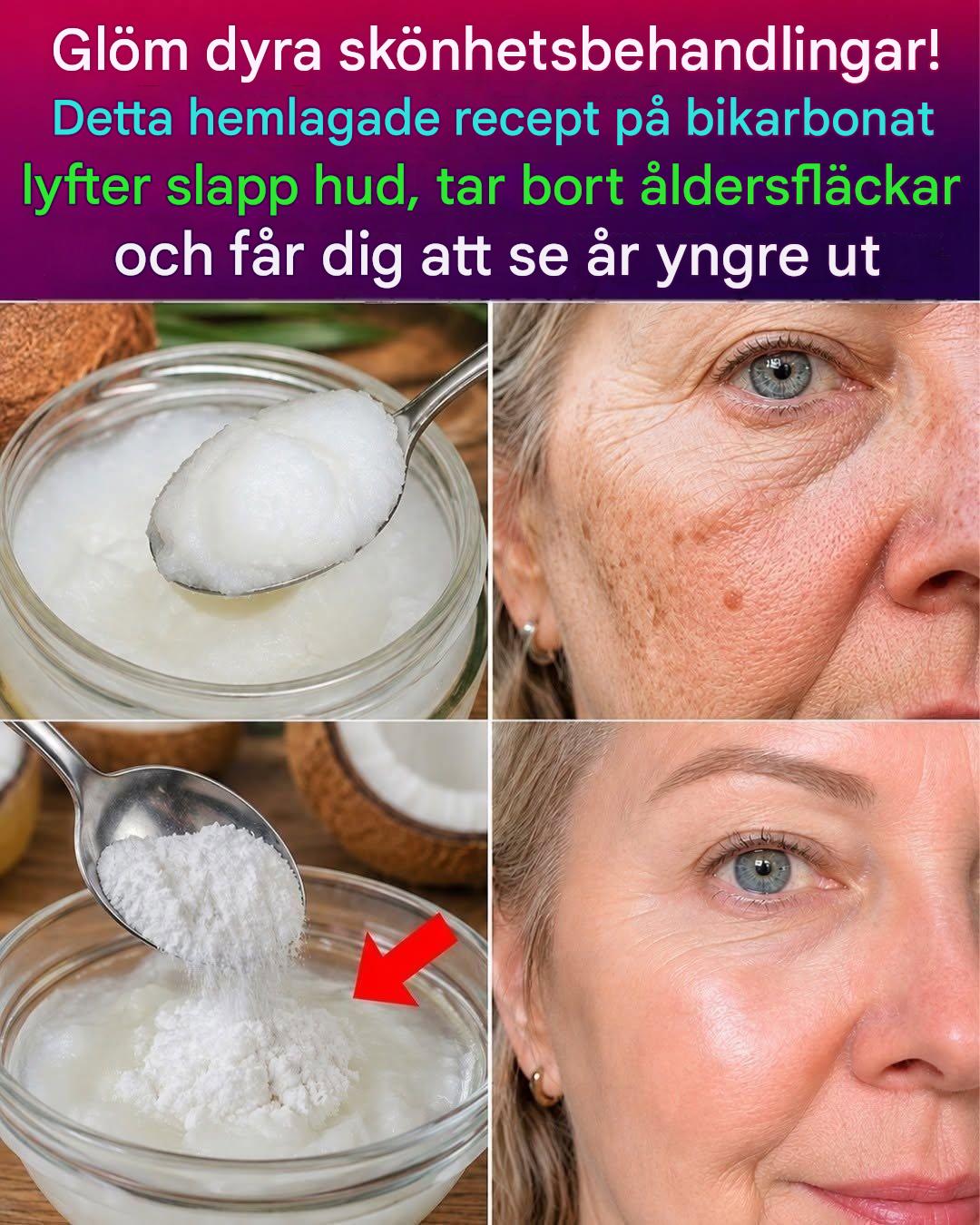 Hemgjord bakpulverkräm utlöser hudbarriärkollaps bakom mörka fläckar