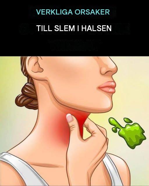 De verkliga orsakerna till konstant slem och mukus i halsen och hur man blir av med det!