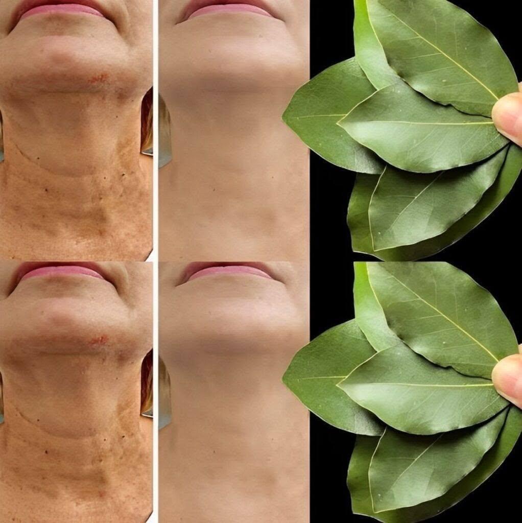 Hur länge kostar det 100 000 kraftfullare att Botox? | Ett naturligt botemedel mot rynkor, även vid 70!