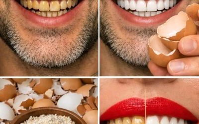Efter 5 minuter blir TÄNDERNAS gula färg PÄRLVITA och glänsande 🥚 – Metod i första kommentaren