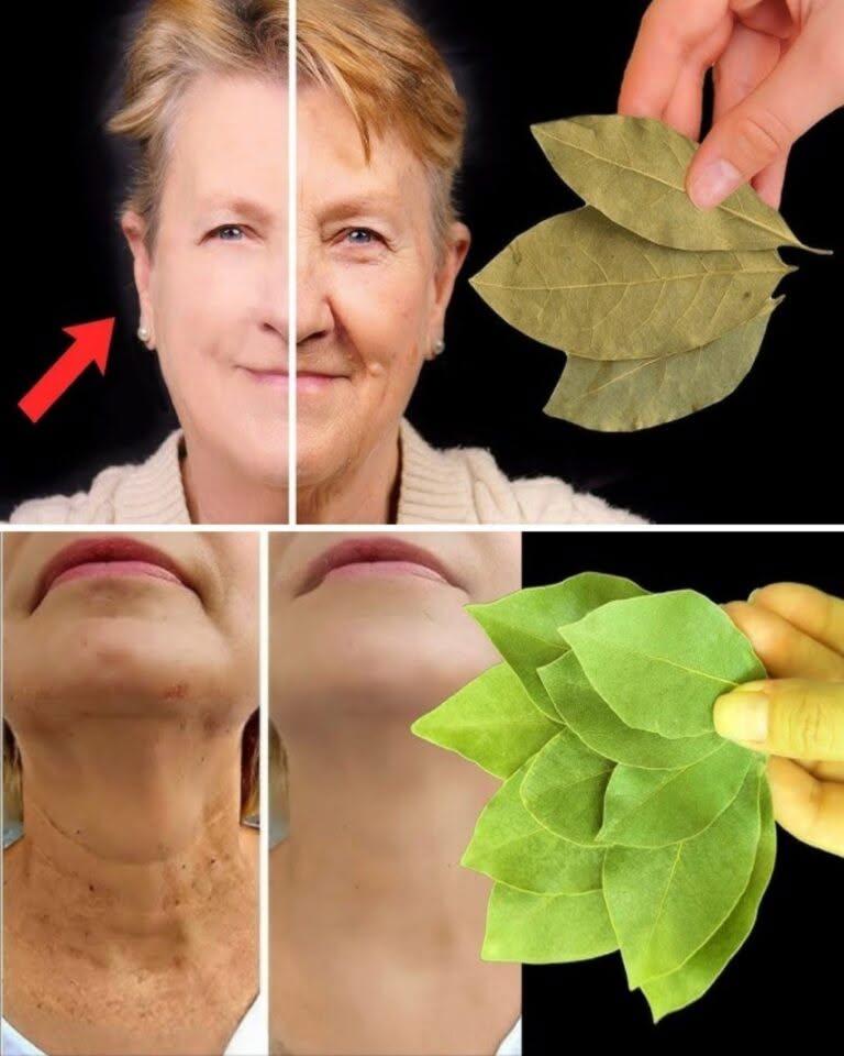 139 Laurel är 100 000 gånger kraftfullare än Botox. Det eliminerar alla rynkor även vid 70. Fortsätt läsa nedan i den första kommentaren. 👇